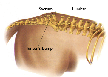Identify and Treat Equine Sacroiliac Problems